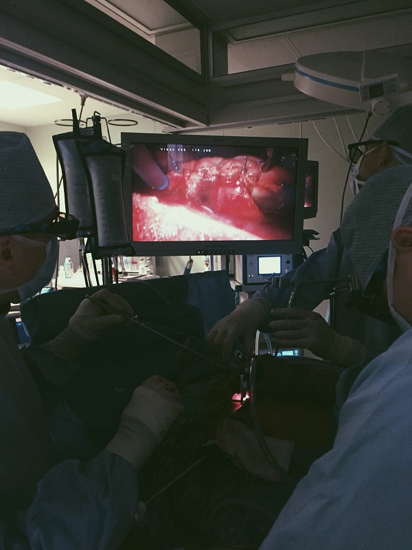 Ход_операции1.jpg Ход_операции1.jpg